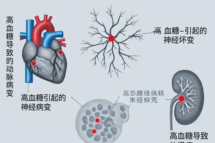 老年人早上空腹血糖20(圖1)