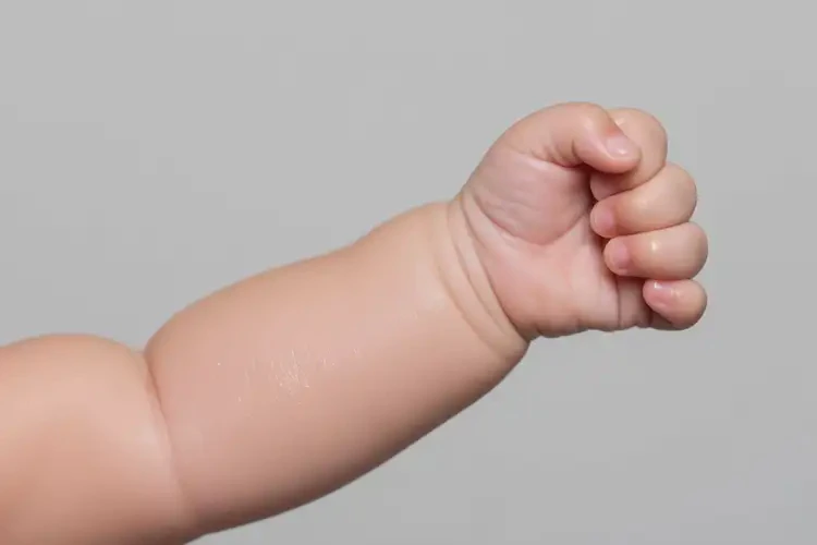 嬰兒手臂上偶爾長濕疹能徹底自愈嗎(圖1)