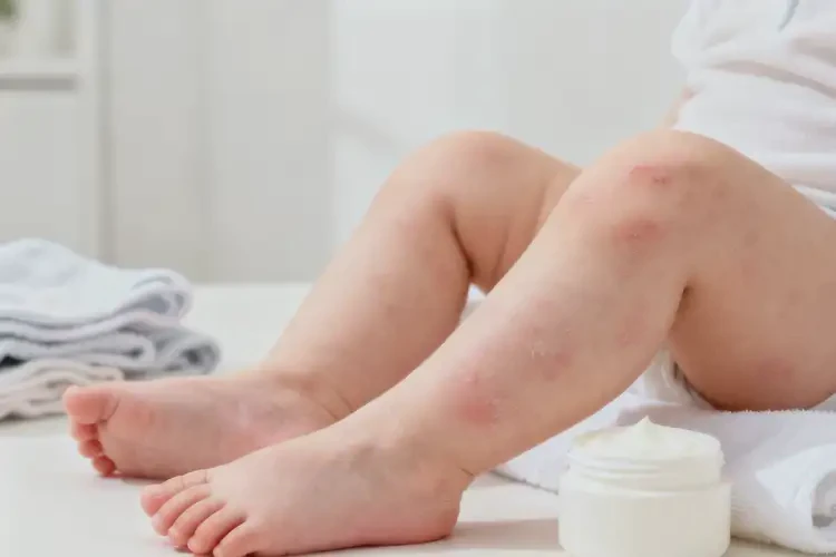 小儿四肢起湿疹可不可以彻底自愈(图1)