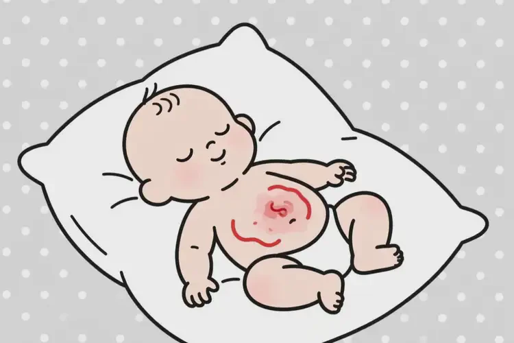 幼儿肚子出湿疹能彻底自愈吗(图2)