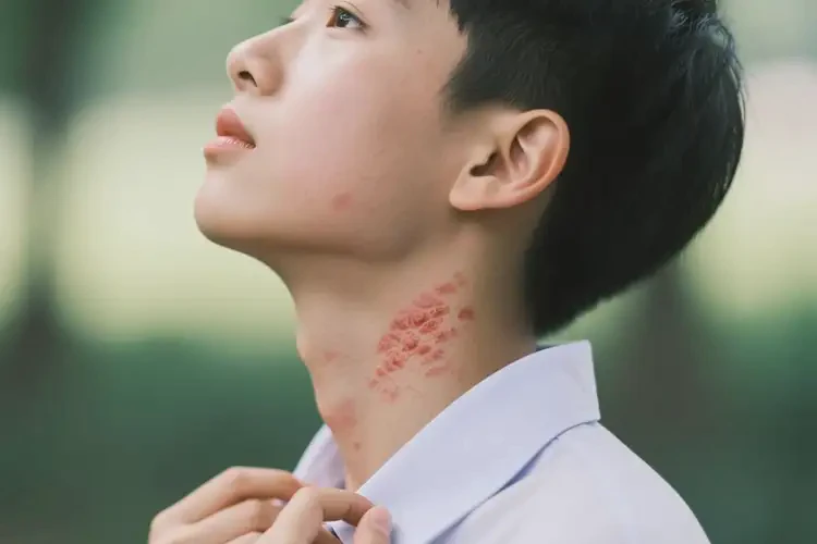小學(xué)生脖子上經(jīng)常起濕疹可不可以徹底自愈(圖1)