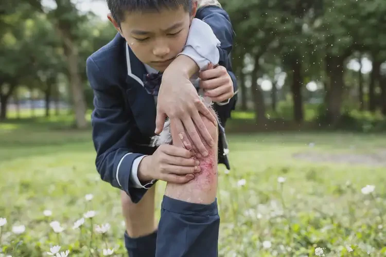 中學(xué)生小腿上經(jīng)常起濕疹可以徹底自愈嗎(圖1)