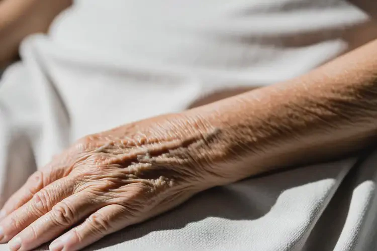 老人手臂上長濕疹能靠自己自愈嗎(圖3)