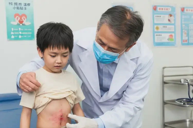 少兒肚子上經常起濕疹能徹底自愈嗎(圖2)