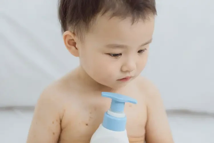 幼兒脖子上出現(xiàn)濕疹可不可以徹底自愈(圖2)