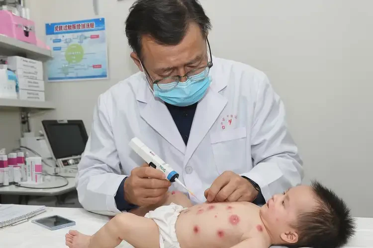 寶寶身上起濕疹可不可以徹底自愈(圖3)