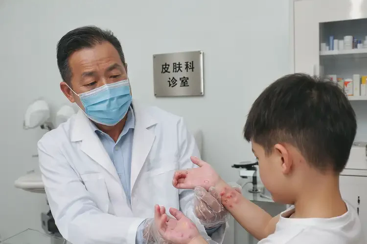 小孩手上偶爾起濕疹能靠自己自愈嗎(圖2)