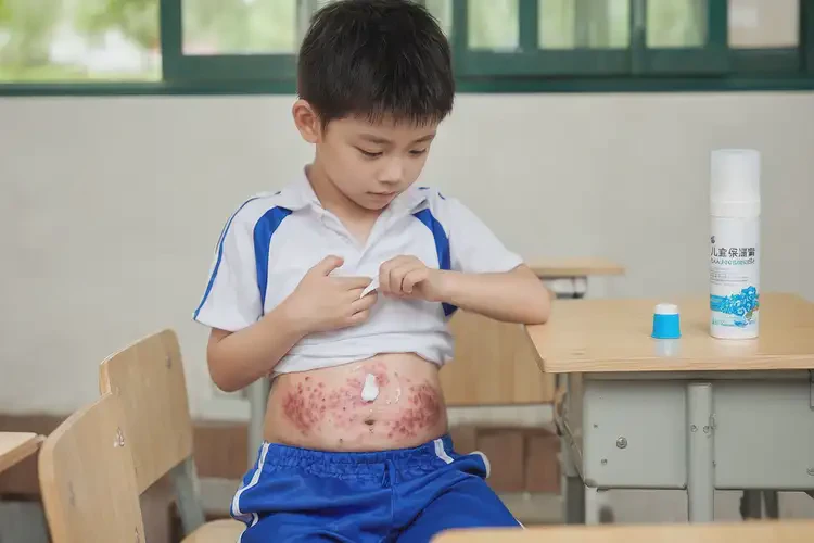小學(xué)生肚子上經(jīng)常起濕疹不管它會(huì)自己痊愈嗎(圖2)