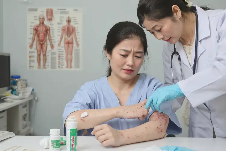 產(chǎn)婦手上偶爾長(zhǎng)濕疹不管它會(huì)自己痊愈嗎(圖2)