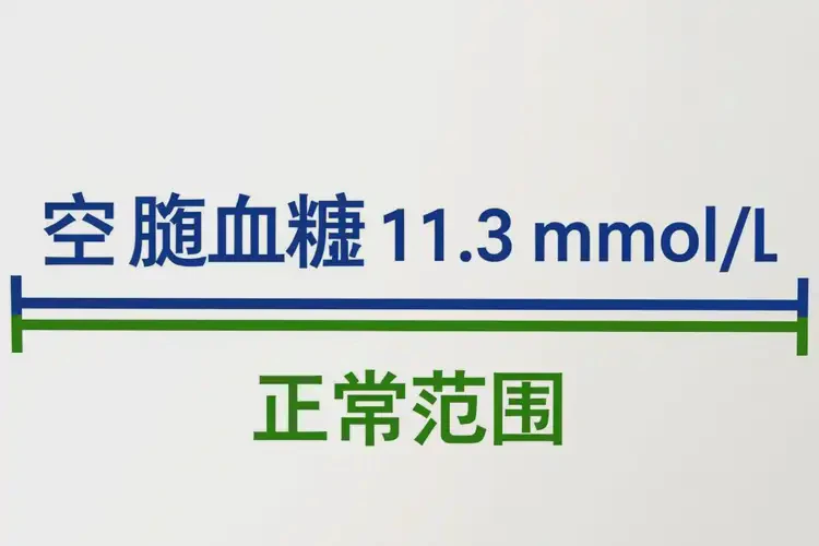 成年人空腹血糖11(圖2)