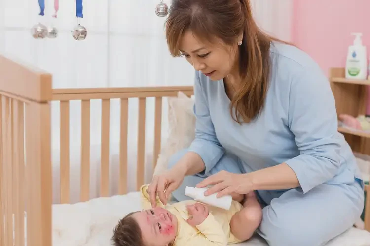 嬰兒面部出現(xiàn)濕疹可以徹底自愈嗎(圖3)