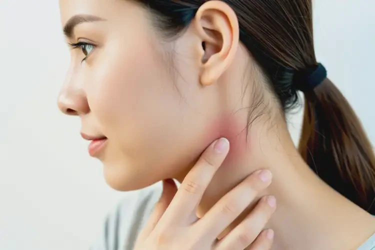 女人脖子有濕疹不管它會(huì)自己好嗎(圖3)