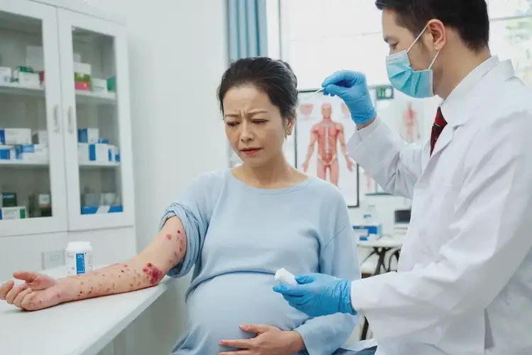 孕婦手臂上偶爾起濕疹不管它會(huì)自己痊愈嗎(圖3)