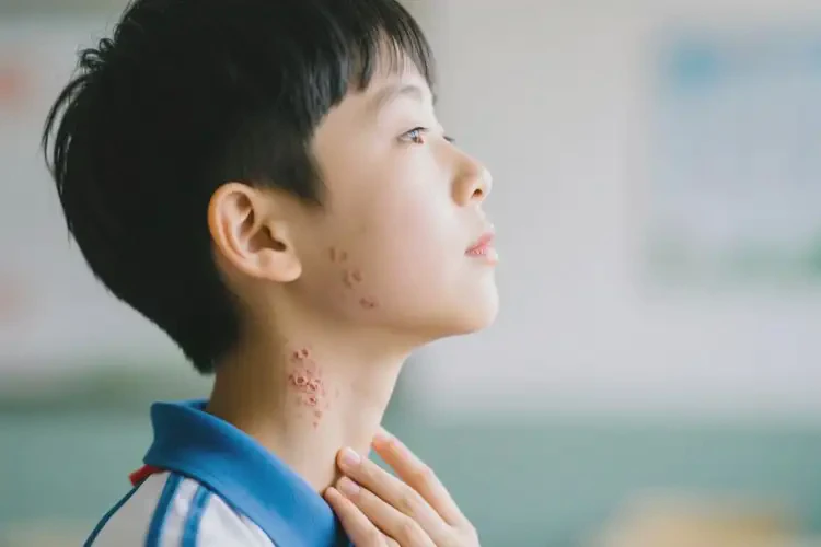 小學(xué)生脖子上經(jīng)常起濕疹可不可以徹底自愈(圖2)