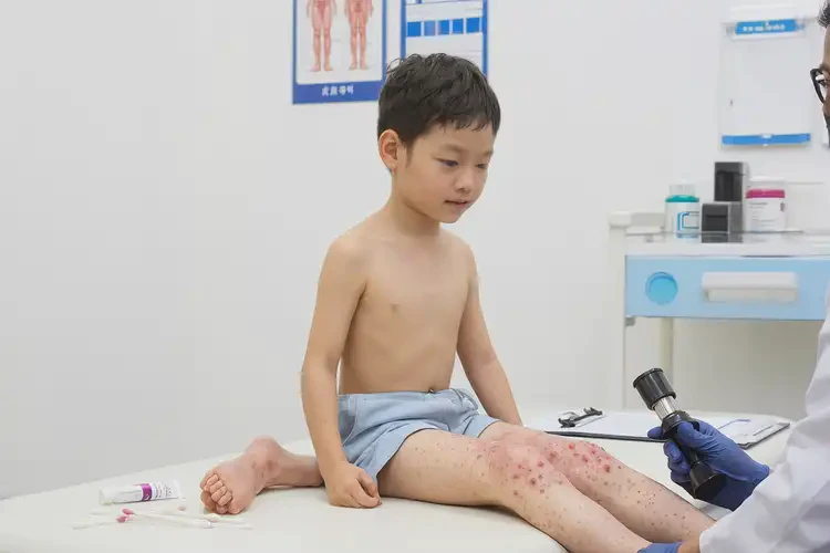 孩子大腿經(jīng)常起濕疹可不可以徹底自愈(圖4)