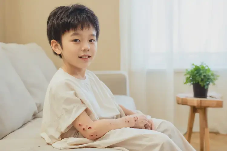 小兒手臂偶爾長濕疹可以徹底自愈嗎(圖2)