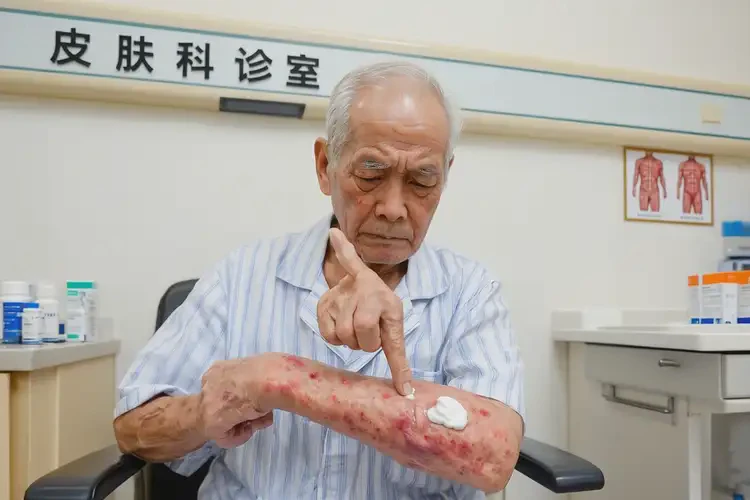 高龄老人全身偶尔起湿疹不管它会自己好吗(图2)