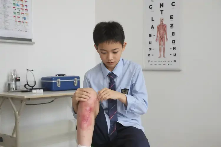 中学生脚上经常长湿疹不管它会自己痊愈吗(图4)