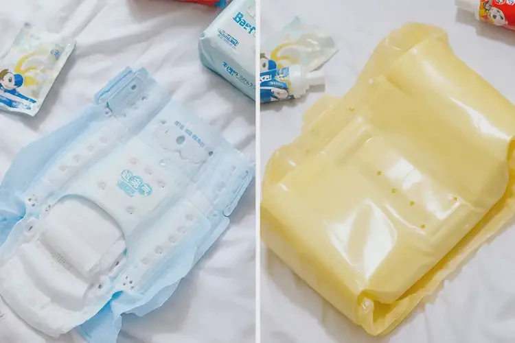 幼兒肛周出濕疹可以徹底自愈嗎(圖2)