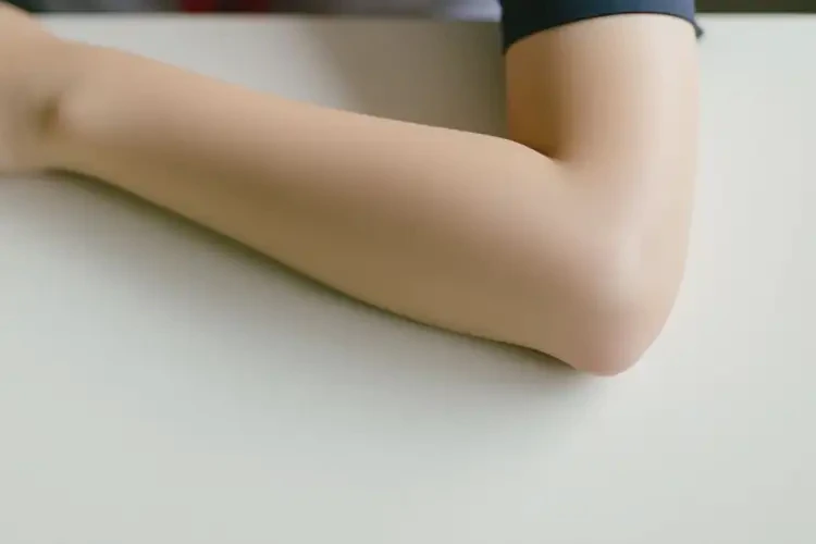 中學(xué)生手臂上偶爾起濕疹可以徹底自愈嗎(圖4)