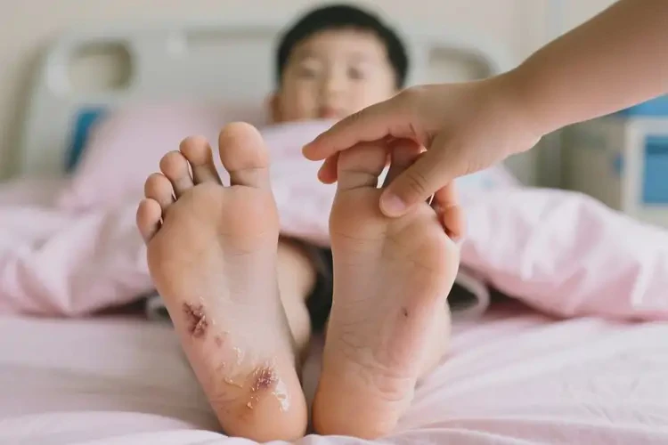 小學(xué)生腳上出現(xiàn)濕疹可不可以徹底自愈(圖1)