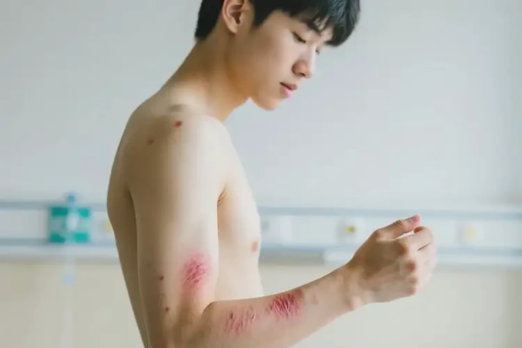 男生手臂上有濕疹可不可以徹底自愈(圖3)