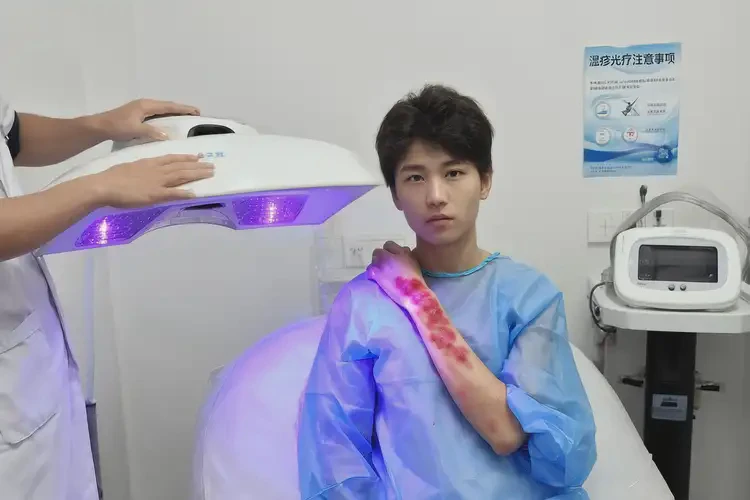 男人全身長濕疹能夠徹底治愈嗎(圖1)