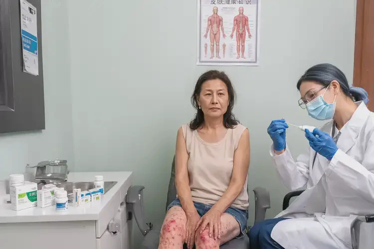 女人小腿容易長濕疹不管它會自己好嗎(圖3)