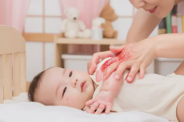 寶寶脖子上容易長(zhǎng)濕疹可不可以徹底自愈(圖2)