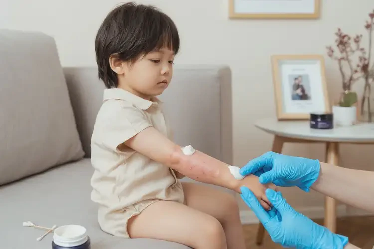 幼兒全身出現(xiàn)濕疹能靠自己自愈嗎(圖2)