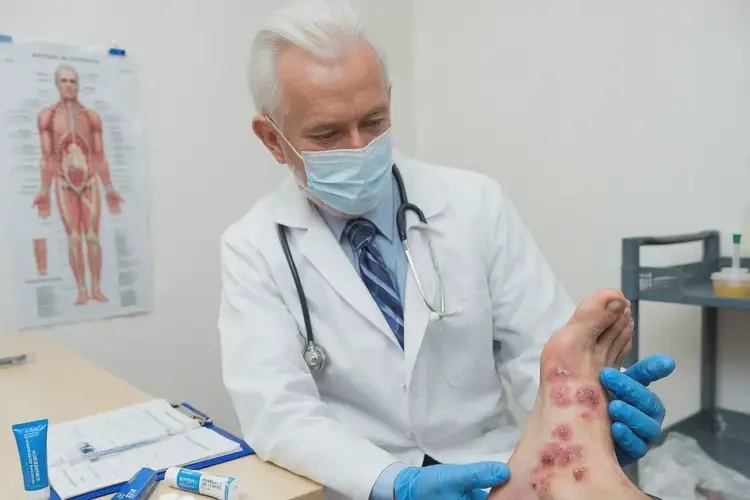 老年人脚上出湿疹能不能彻底自愈(图3)