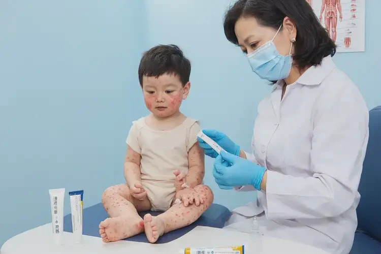 幼兒全身容易起濕疹不管它會自己痊愈嗎(圖3)