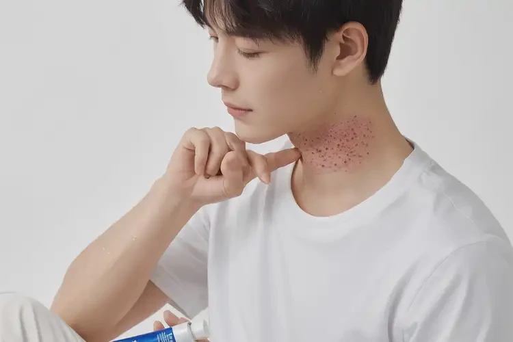 青年人脖子上有湿疹能彻底自愈吗(图3)