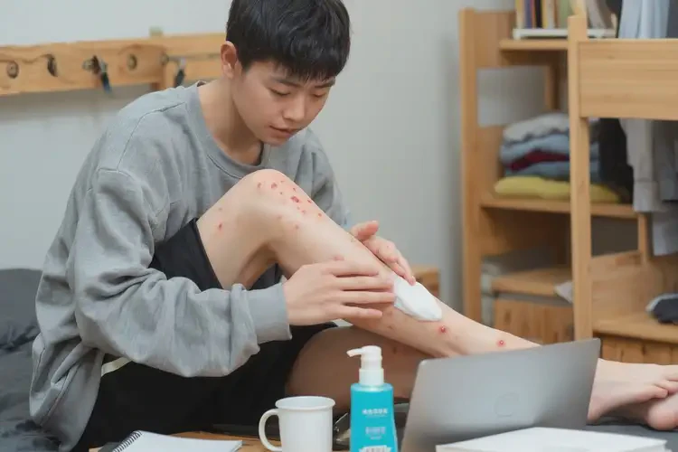 大學生小腿上容易長濕疹可不可以徹底自愈(圖2)