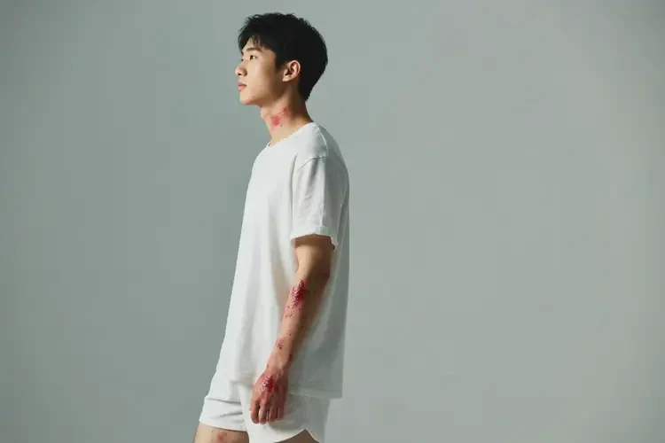 青年人全身偶爾長濕疹不管它會自己好嗎(圖4)