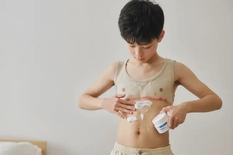 青少年肚子容易長濕疹能徹底自愈嗎(圖3)