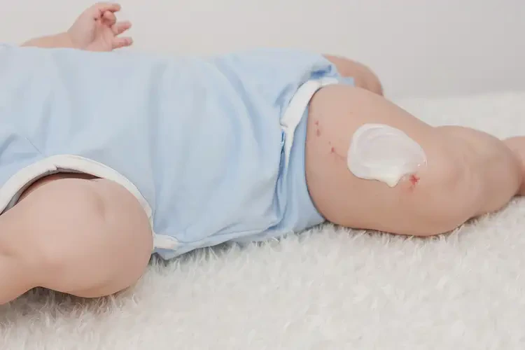 嬰兒大腿上經(jīng)常起濕疹能夠徹底治愈嗎(圖2)