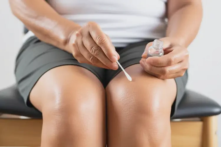 老年人大腿偶爾長(zhǎng)濕疹能夠徹底治愈嗎(圖2)