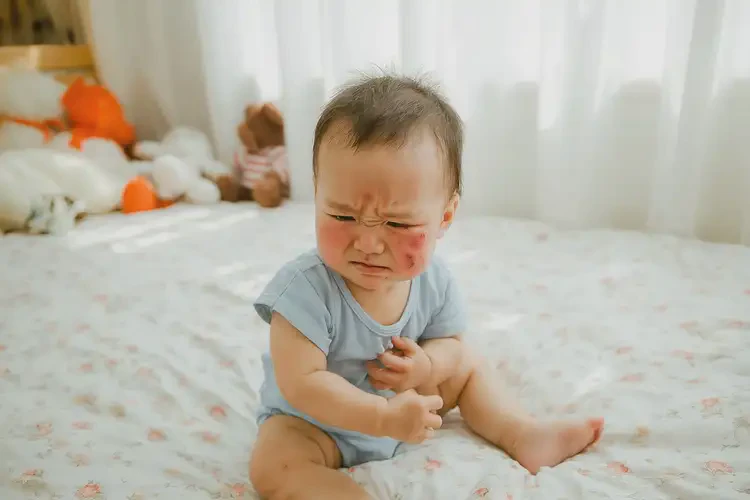 嬰幼兒臉上容易起濕疹可以徹底自愈嗎(圖3)