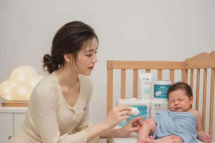 新生兒全身容易起濕疹能夠徹底治愈嗎(圖3)