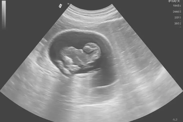 孕16周1天胎心率164寶寶還能要嗎(圖4)