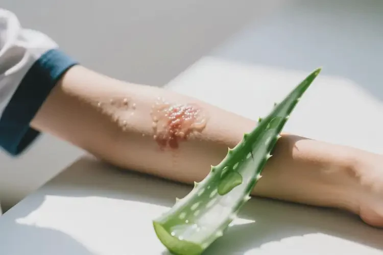 中學(xué)生手臂經(jīng)常長濕疹不管它會自己好嗎(圖2)