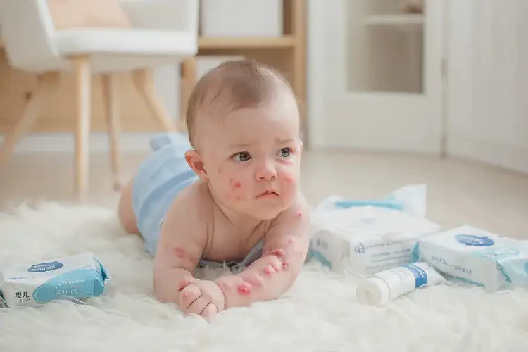 婴儿四肢偶尔长湿疹能靠自己自愈吗(图1)