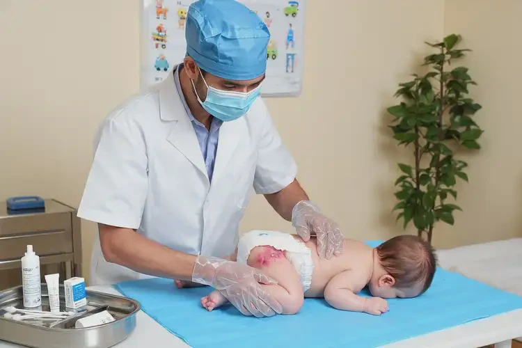 嬰幼兒肛周容易長濕疹可以徹底自愈嗎(圖2)