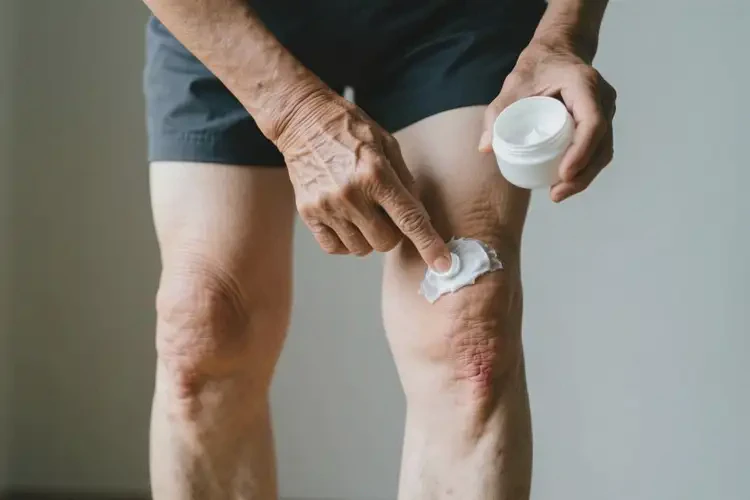 老年人大腿偶爾長(zhǎng)濕疹能夠徹底治愈嗎(圖1)