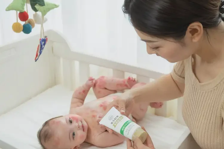 嬰兒大腿長濕疹能夠徹底治愈嗎(圖2)