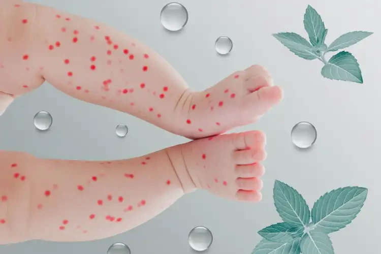 嬰幼兒四肢經(jīng)常起濕疹能徹底自愈嗎(圖1)