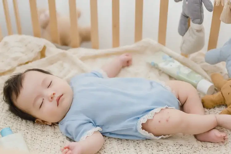 婴儿手臂容易起湿疹不管它会自己好吗(图2)