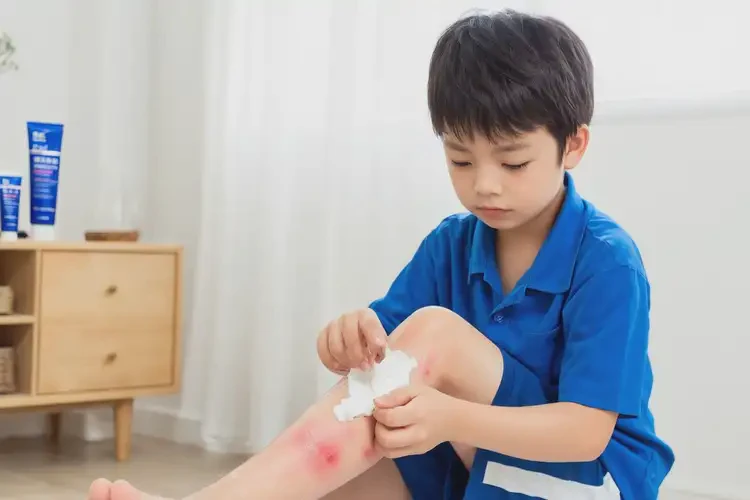 小學(xué)生小腿經(jīng)常起濕疹不管它會(huì)自己自愈嗎(圖2)