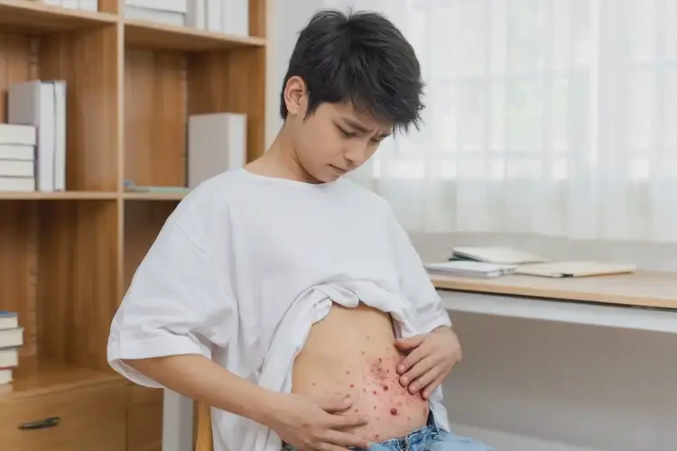 大學(xué)生肚子上容易起濕疹能不能徹底自愈(圖3)